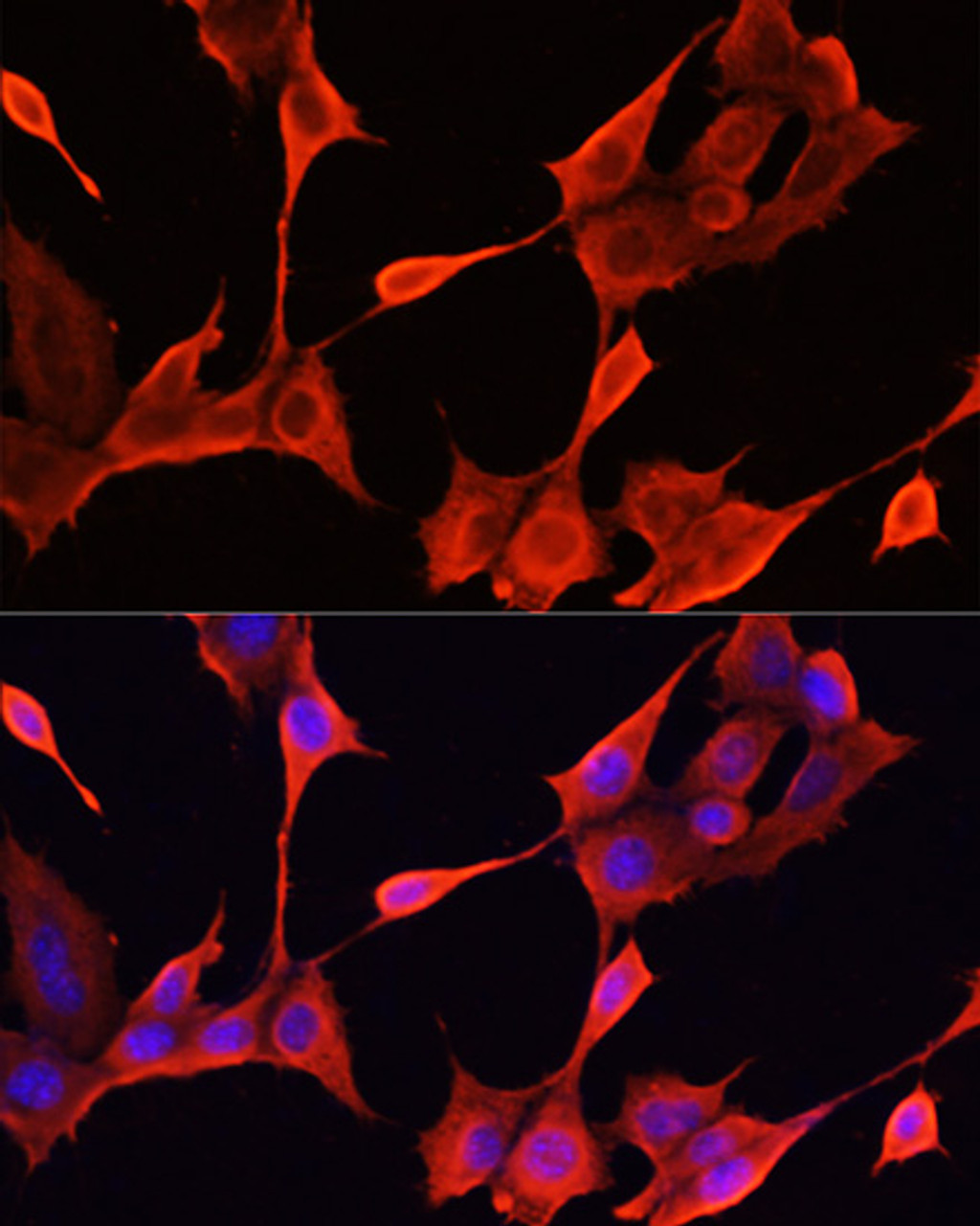 Immunofluorescence analysis of NIH/3T3 cells using KRT1 antibody (16-521) at dilution of 1:100. Blue: DAPI for nuclear staining.