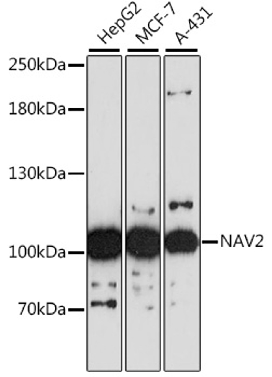 Western blot analysis of extracts of various cell lines, using NAV2 antibody (16-535) at 1:3000 dilution.<br/>Secondary antibody: HRP Goat Anti-Rabbit IgG (H+L) at 1:10000 dilution.<br/>Lysates/proteins: 25ug per lane.<br/>Blocking buffer: 3% nonfat dry milk in TBST.<br/>Detection: ECL Basic Kit.<br/>Exposure time: 90s.