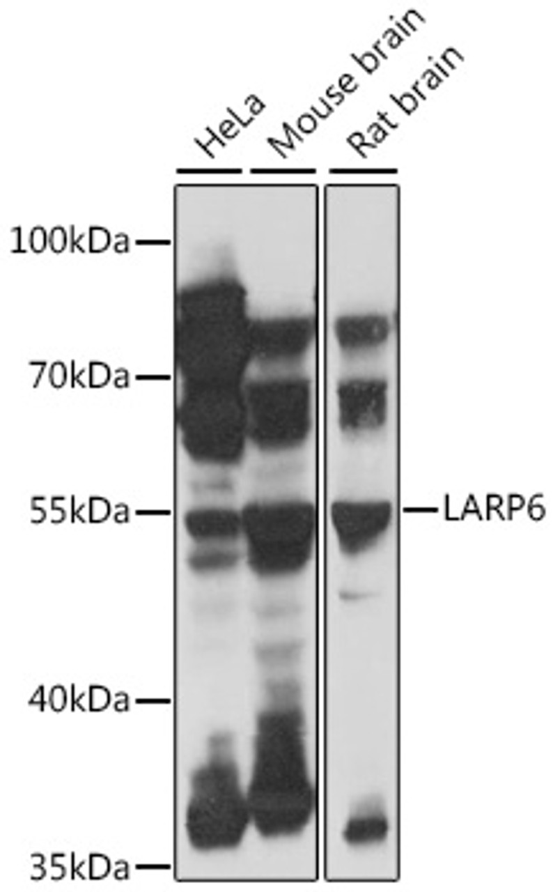 Western blot analysis of extracts of various cell lines, using LARP6 antibody (16-555) at 1:1000 dilution.<br/>Secondary antibody: HRP Goat Anti-Rabbit IgG (H+L) at 1:10000 dilution.<br/>Lysates/proteins: 25ug per lane.<br/>Blocking buffer: 3% nonfat dry milk in TBST.<br/>Detection: ECL Basic Kit.<br/>Exposure time: 3s.