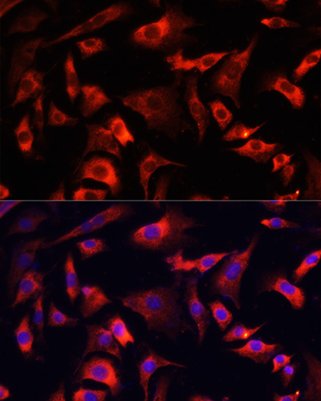 Immunofluorescence analysis of NIH/3T3 cells using FXR1 antibody (16-610) at dilution of 1:100. Blue: DAPI for nuclear staining.