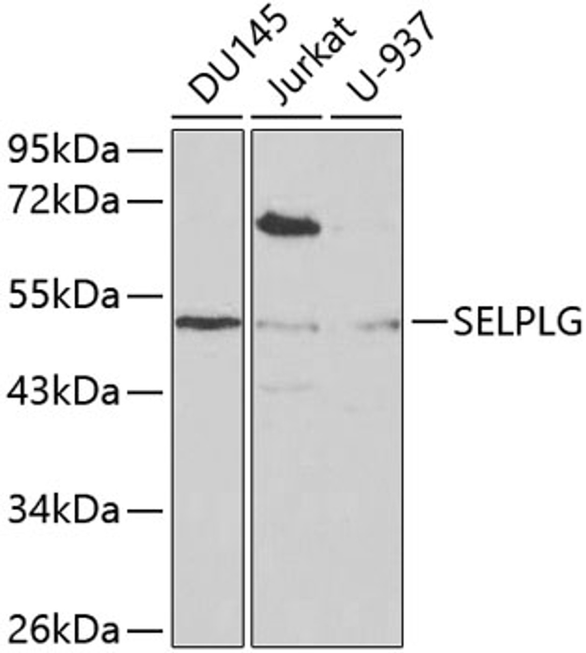 Western blot analysis of extracts of various cell lines, using SELPLG antibody (16-672) at 1:1000 dilution.<br/>Secondary antibody: HRP Goat Anti-Rabbit IgG (H+L) at 1:10000 dilution.<br/>Lysates/proteins: 25ug per lane.<br/>Blocking buffer: 3% nonfat dry milk in TBST.
