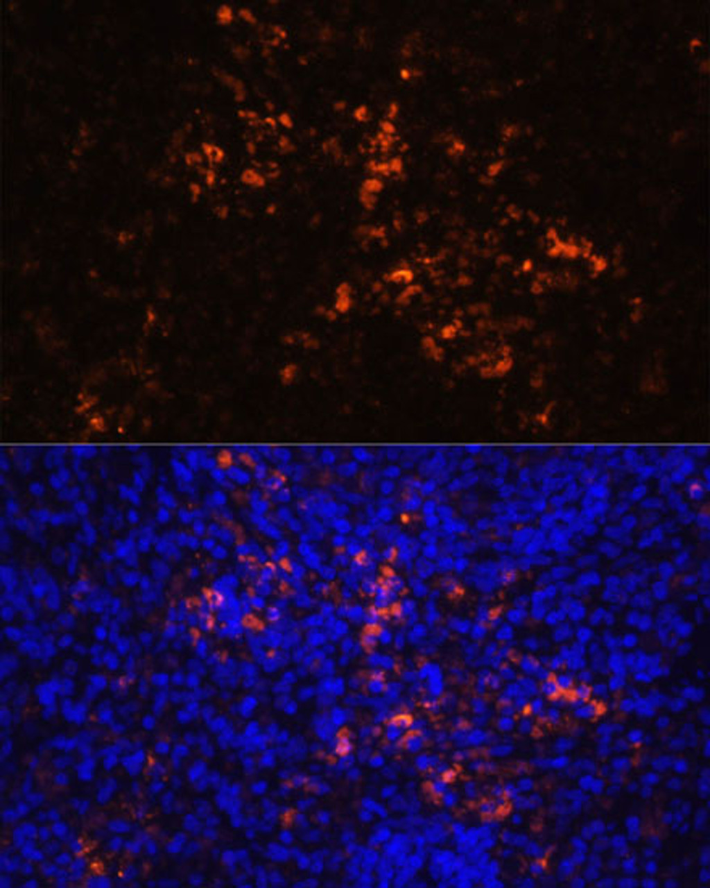 Immunofluorescence analysis of rat spleen using CD70 Polyclonal Antibody (16-719) at dilution of 1:100 (40x lens) . Blue: DAPI for nuclear staining.