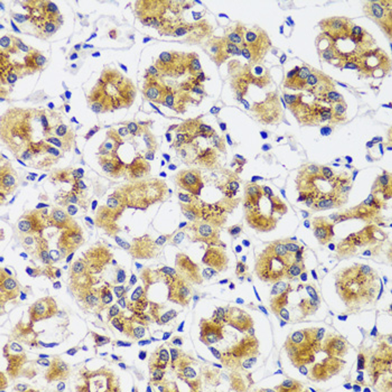 Immunohistochemistry of paraffin-embedded human stomach using CASQ1 antibody (16-752) at dilution of 1:100 (40x lens) .