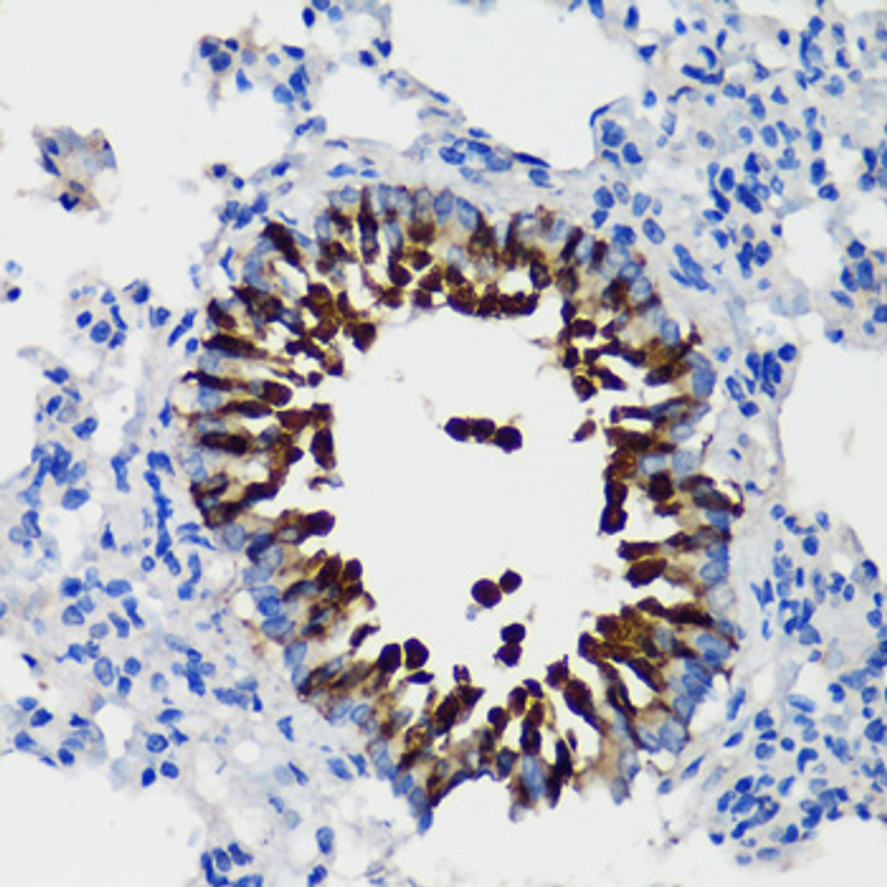 Immunohistochemistry of paraffin-embedded rat lung using SCGB1A1 antibody (16-828) at dilution of 1:100 (40x lens) .
