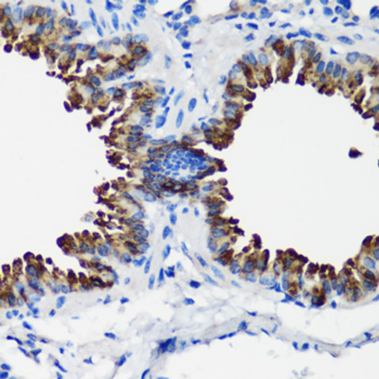 Immunohistochemistry of paraffin-embedded mouse lung using SCGB1A1 antibody (16-828) at dilution of 1:100 (40x lens) .