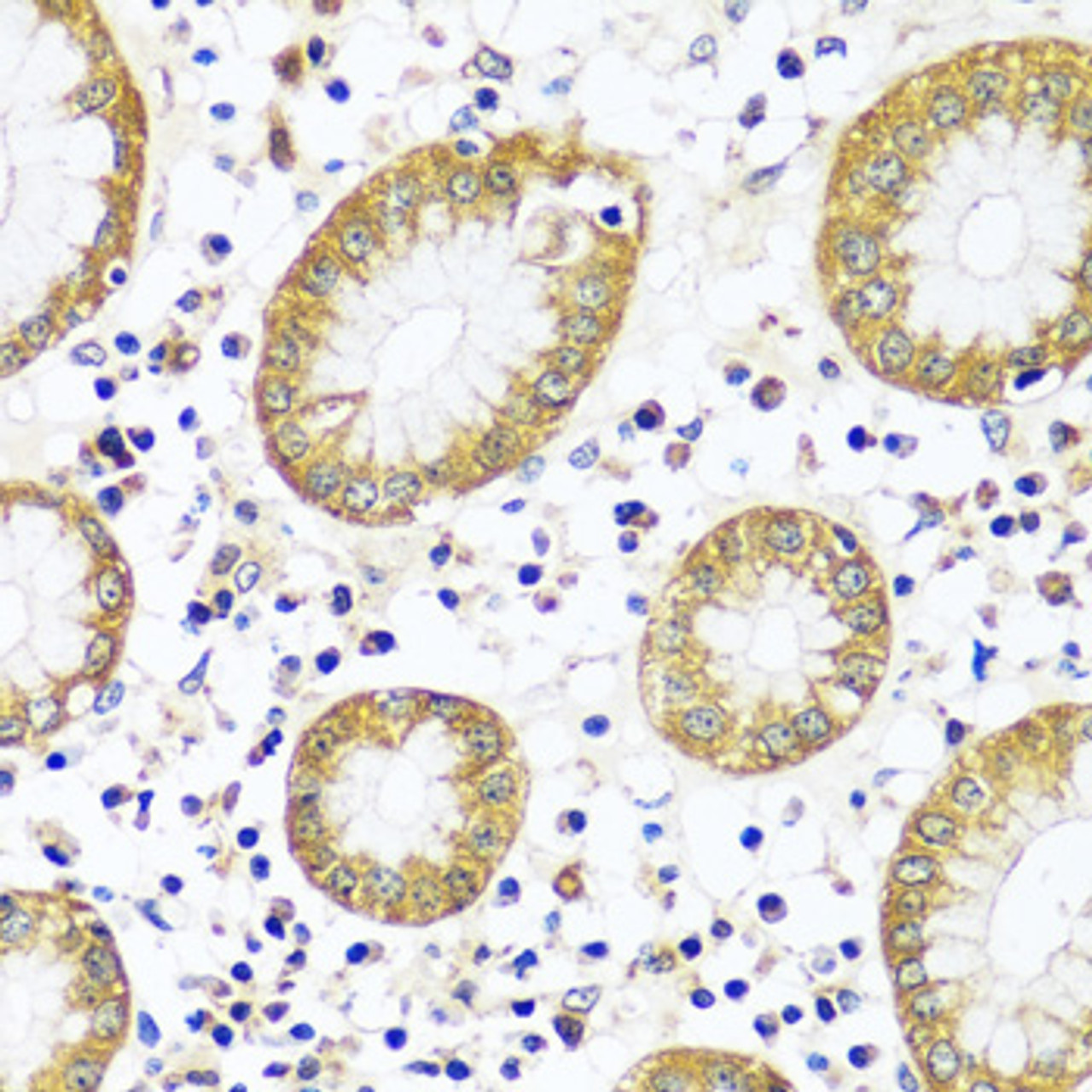 Immunohistochemistry of paraffin-embedded human stomach using CAPN9 antibody (16-860) at dilution of 1:100 (40x lens) .