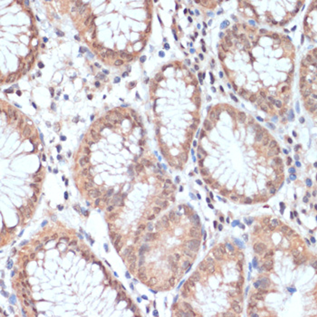 Immunohistochemistry of paraffin-embedded human stomach using PRMT7 antibody (16-877) at dilution of 1:200 (40x lens) .