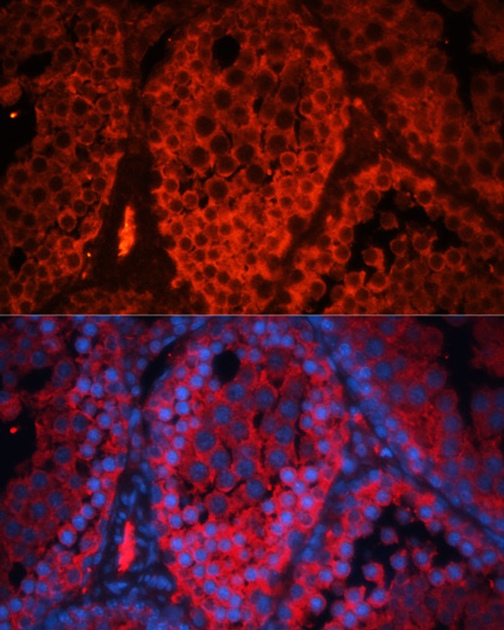 Immunofluorescence analysis of mouse testis using Kctd19 antibody (16-901) at dilution of 1:100. Blue: DAPI for nuclear staining.