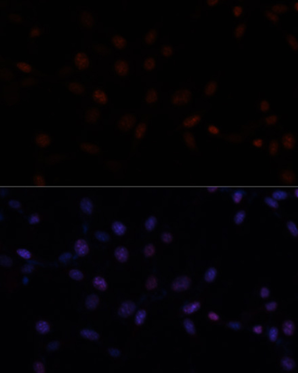 Immunofluorescence analysis of NIH-3T3 cells using Ki67 antibody (16-921) at dilution of 1:100. Blue: DAPI for nuclear staining.