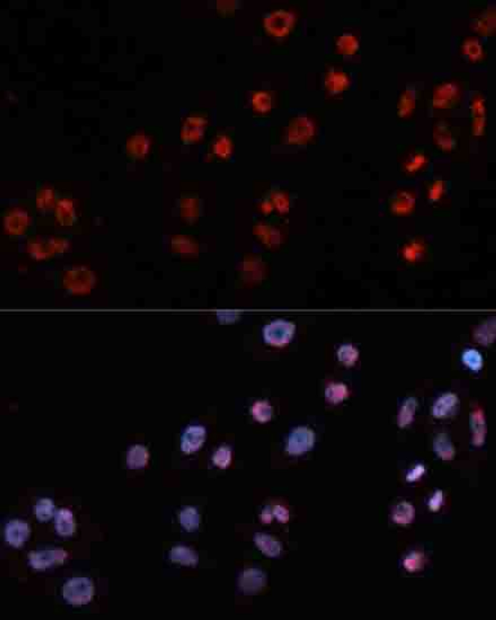 Immunofluorescence analysis of HeLa cells using MT2A antibody (16-943) at dilution of 1:100. Blue: DAPI for nuclear staining.