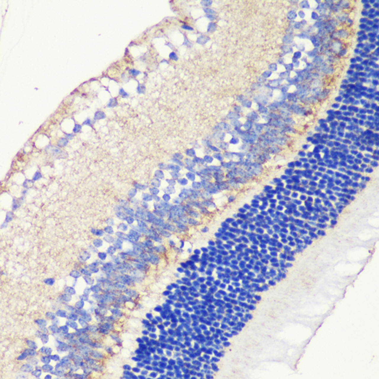 Immunohistochemistry of paraffin-embedded mouse retina using TRPM1 antibody (16-964) at dilution of 1:200 (40x lens) .