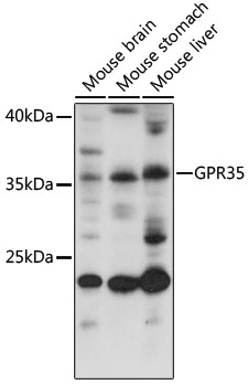 Western blot analysis of extracts of various cell lines, using GPR35 antibody (18-168) at 1:1000 dilution.<br/>Secondary antibody: HRP Goat Anti-Rabbit IgG (H+L) at 1:10000 dilution.<br/>Lysates/proteins: 25ug per lane.<br/>Blocking buffer: 3% nonfat dry milk in TBST.<br/>Detection: ECL Basic Kit.<br/>Exposure time: 1s.