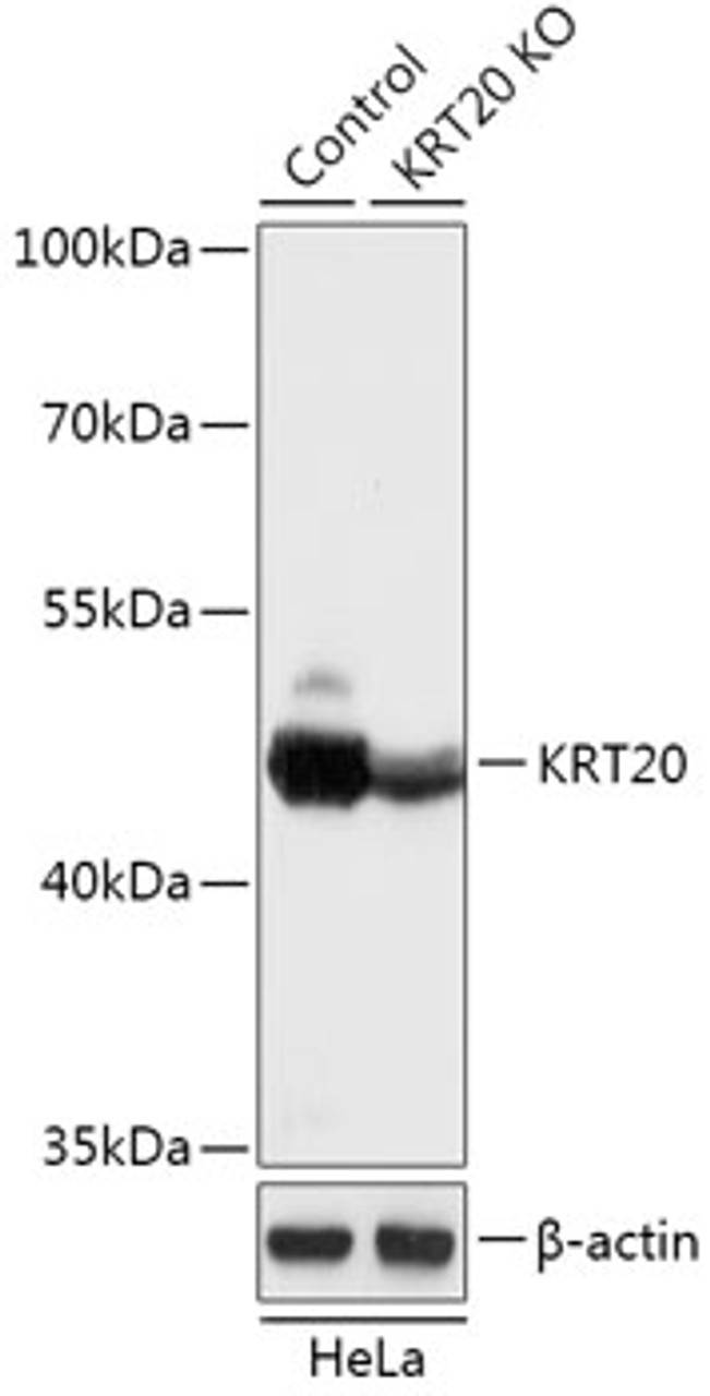 Western blot analysis of extracts from normal (control) and KRT20 knockout (KO) HeLa cells, using KRT20 antibody (18-183) at 1:1000 dilution.<br/>Secondary antibody: HRP Goat Anti-Rabbit IgG (H+L) at 1:10000 dilution.<br/>Lysates/proteins: 25ug per lane.<br/>Blocking buffer: 3% nonfat dry milk in TBST.<br/>Detection: ECL Basic Kit.<br/>Exposure time: 1s.