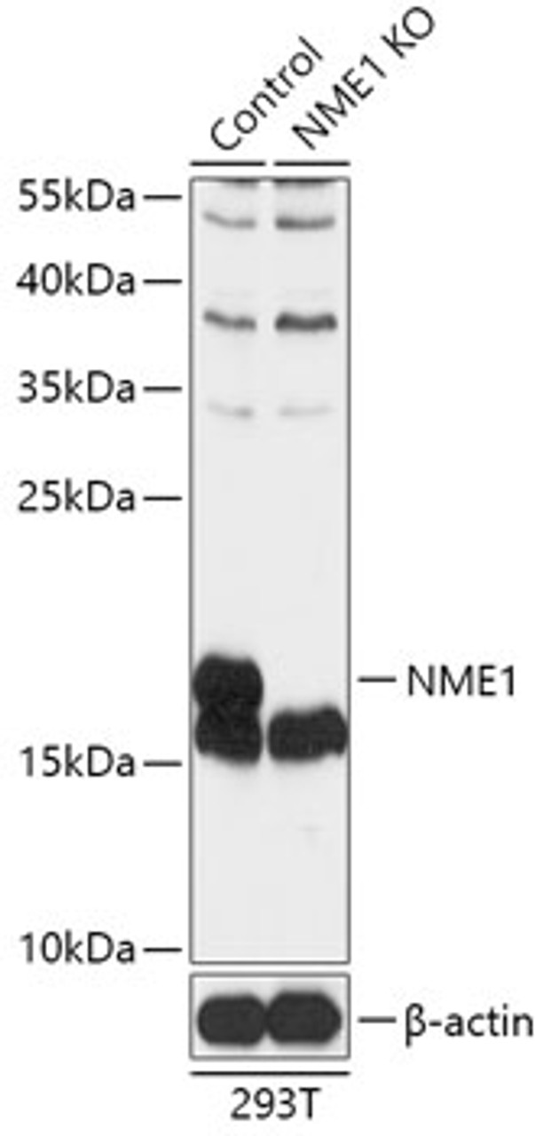Western blot analysis of extracts from normal (control) and NME1 knockout (KO) 293T cells, using NME1 antibody (18-185) at 1:1000 dilution.<br/>Secondary antibody: HRP Goat Anti-Rabbit IgG (H+L) at 1:10000 dilution.<br/>Lysates/proteins: 25ug per lane.<br/>Blocking buffer: 3% nonfat dry milk in TBST.<br/>Detection: ECL Basic Kit.<br/>Exposure time: 5s.