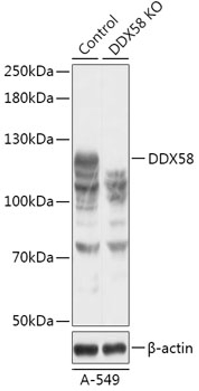 Western blot analysis of extracts from normal (control) and DDX58 knockout (KO) A-549 cells, using DDX58 antibody (18-190) at 1:500 dilution.<br/>Secondary antibody: HRP Goat Anti-Rabbit IgG (H+L) at 1:10000 dilution.<br/>Lysates/proteins: 25ug per lane.<br/>Blocking buffer: 3% nonfat dry milk in TBST.<br/>Detection: ECL Basic Kit.<br/>Exposure time: 1min.