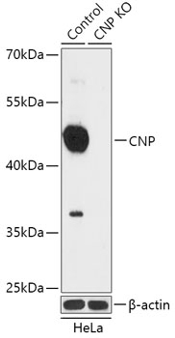 Western blot analysis of extracts from normal (control) and CNP knockout (KO) HeLa cells, using CNP antibody (18-196) at 1:1000 dilution.<br/>Secondary antibody: HRP Goat Anti-Rabbit IgG (H+L) at 1:10000 dilution.<br/>Lysates/proteins: 25ug per lane.<br/>Blocking buffer: 3% nonfat dry milk in TBST.<br/>Detection: ECL Basic Kit.<br/>Exposure time: 90s.