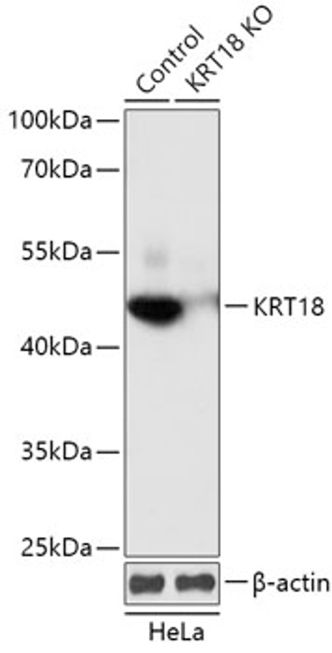 Western blot analysis of extracts from normal (control) and KRT18 knockout (KO) HeLa cells, using KRT18 antibody (18-197) at 1:1000 dilution.<br/>Secondary antibody: HRP Goat Anti-Rabbit IgG (H+L) at 1:10000 dilution.<br/>Lysates/proteins: 25ug per lane.<br/>Blocking buffer: 3% nonfat dry milk in TBST.<br/>Detection: ECL Basic Kit.<br/>Exposure time: 1s.
