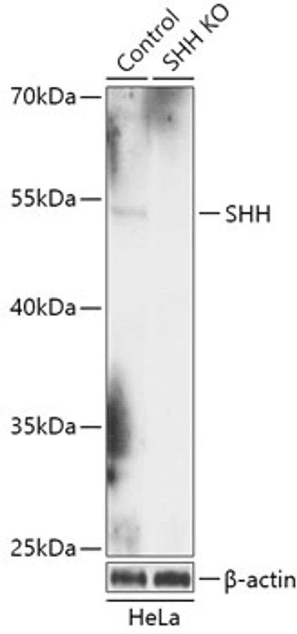 Western blot analysis of extracts from normal (control) and SHH knockout (KO) HeLa cells, using SHH antibody (18-208) at 1:1000 dilution.<br/>Secondary antibody: HRP Goat Anti-Rabbit IgG (H+L) at 1:10000 dilution.<br/>Lysates/proteins: 25ug per lane.<br/>Blocking buffer: 3% nonfat dry milk in TBST.<br/>Detection: ECL Basic Kit.<br/>Exposure time: 10s.