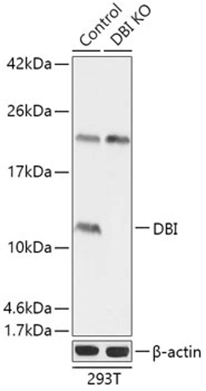 Western blot analysis of extracts from normal (control) and DBI knockout (KO) 293T cells, using DBI antibody (18-212) at 1:1000 dilution.<br/>Secondary antibody: HRP Goat Anti-Rabbit IgG (H+L) at 1:10000 dilution.<br/>Lysates/proteins: 25ug per lane.<br/>Blocking buffer: 3% nonfat dry milk in TBST.<br/>Detection: ECL Basic Kit.<br/>Exposure time: 1s.
