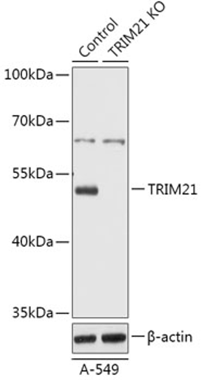 Western blot analysis of extracts from normal (control) and TRIM21 knockout (KO) A-549 cells, using TRIM21 antibody (18-215) at 1:1000 dilution.<br/>Secondary antibody: HRP Goat Anti-Rabbit IgG (H+L) at 1:10000 dilution.<br/>Lysates/proteins: 25ug per lane.<br/>Blocking buffer: 3% nonfat dry milk in TBST.<br/>Detection: ECL Basic Kit.<br/>Exposure time: 1s.