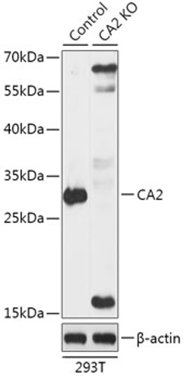 Western blot analysis of extracts from normal (control) and CA2 knockout (KO) 293T cells, using CA2 antibody (18-222) at 1:1000 dilution.<br/>Secondary antibody: HRP Goat Anti-Rabbit IgG (H+L) at 1:10000 dilution.<br/>Lysates/proteins: 25ug per lane.<br/>Blocking buffer: 3% nonfat dry milk in TBST.<br/>Detection: ECL Basic Kit.<br/>Exposure time: 5s.