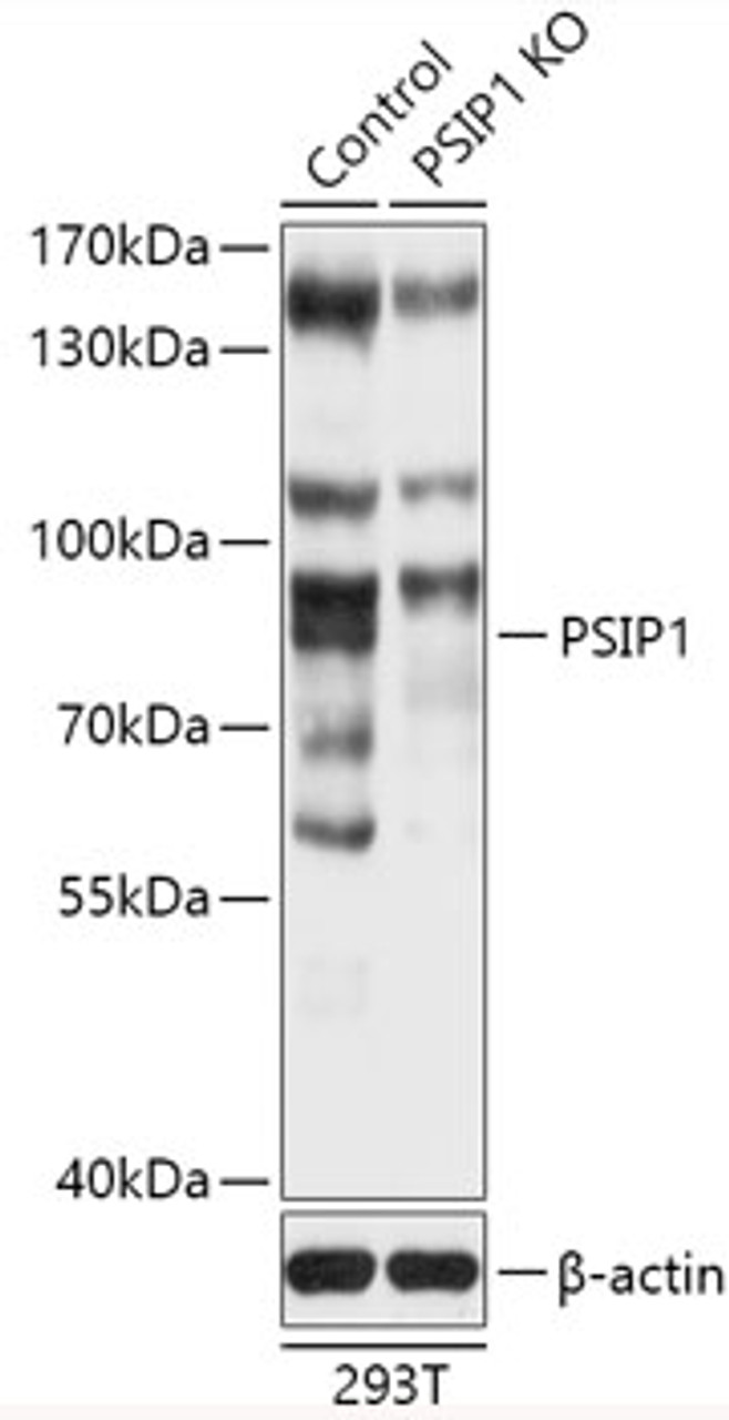 Western blot analysis of extracts from normal (control) and PSIP1 knockout (KO) 293T cells, using PSIP1 antibody (18-225) at 1:1000 dilution.<br/>Secondary antibody: HRP Goat Anti-Rabbit IgG (H+L) at 1:10000 dilution.<br/>Lysates/proteins: 25ug per lane.<br/>Blocking buffer: 3% nonfat dry milk in TBST.<br/>Detection: ECL Basic Kit.<br/>Exposure time: 1s.