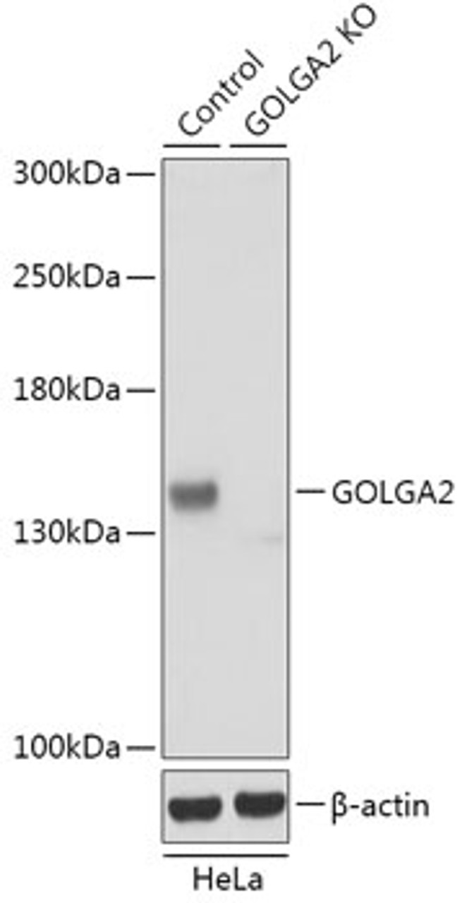 Western blot analysis of extracts from normal (control) and GOLGA2 knockout (KO) HeLa cells, using GOLGA2 antibody (18-230) at 1:1000 dilution.<br/>Secondary antibody: HRP Goat Anti-Rabbit IgG (H+L) at 1:10000 dilution.<br/>Lysates/proteins: 25ug per lane.<br/>Blocking buffer: 3% nonfat dry milk in TBST.<br/>Detection: ECL Basic Kit.<br/>Exposure time: 10s.