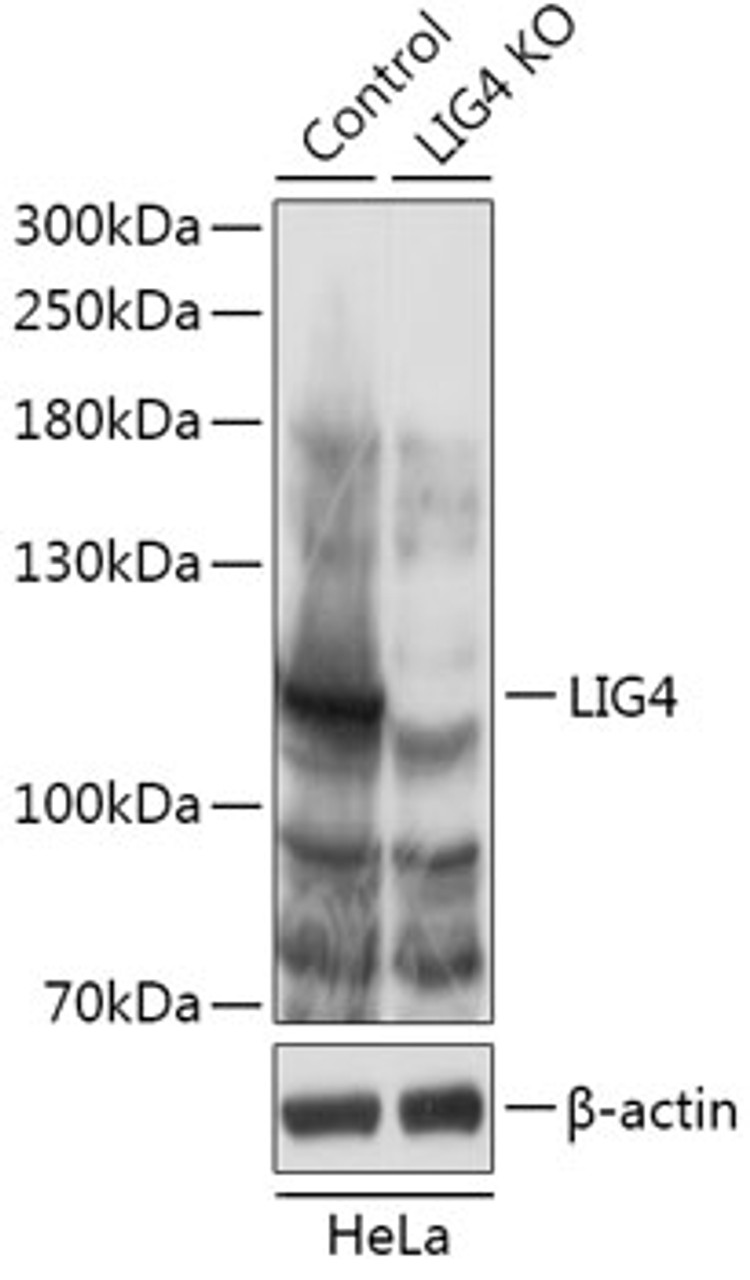 Western blot analysis of extracts from normal (control) and LIG4 knockout (KO) HeLa cells, using LIG4 antibody (18-239) at 1:1000 dilution.<br/>Secondary antibody: HRP Goat Anti-Rabbit IgG (H+L) at 1:10000 dilution.<br/>Lysates/proteins: 25ug per lane.<br/>Blocking buffer: 3% nonfat dry milk in TBST.<br/>Detection: ECL Basic Kit.<br/>Exposure time: 1min.