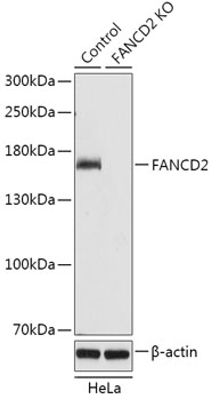Western blot analysis of extracts from normal (control) and FANCD2 knockout (KO) HeLa cells, using FANCD2 antibody (18-244) at 1:1000 dilution.<br/>Secondary antibody: HRP Goat Anti-Rabbit IgG (H+L) at 1:10000 dilution.<br/>Lysates/proteins: 25ug per lane.<br/>Blocking buffer: 3% nonfat dry milk in TBST.<br/>Detection: ECL Basic Kit.<br/>Exposure time: 10s.