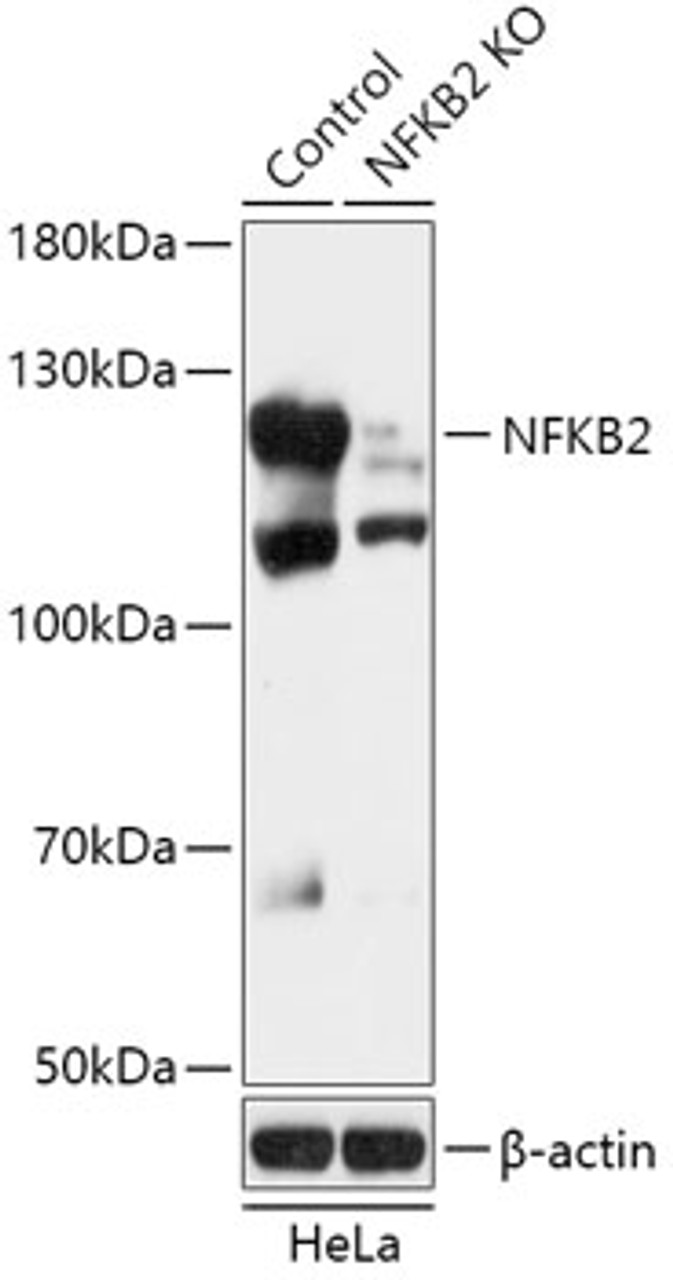 Western blot analysis of extracts from normal (control) and NFKB2 knockout (KO) HeLa cells, using NFKB2 antibody (18-252) at 1:1000 dilution.<br/>Secondary antibody: HRP Goat Anti-Rabbit IgG (H+L) at 1:10000 dilution.<br/>Lysates/proteins: 25ug per lane.<br/>Blocking buffer: 3% nonfat dry milk in TBST.<br/>Detection: ECL Basic Kit.<br/>Exposure time: 10s.