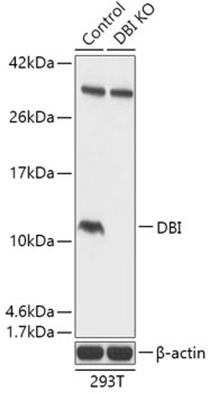 Western blot analysis of extracts from normal (control) and DBI knockout (KO) 293T cells, using DBI antibody (18-258) at 1:1000 dilution.<br/>Secondary antibody: HRP Goat Anti-Rabbit IgG (H+L) at 1:10000 dilution.<br/>Lysates/proteins: 25ug per lane.<br/>Blocking buffer: 3% nonfat dry milk in TBST.<br/>Detection: ECL Basic Kit.<br/>Exposure time: 1s.