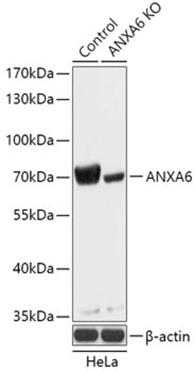 Western blot analysis of extracts from normal (control) and ANXA6 knockout (KO) HeLa cells, using ANXA6 antibody (18-259) at 1:1000 dilution.<br/>Secondary antibody: HRP Goat Anti-Rabbit IgG (H+L) at 1:10000 dilution.<br/>Lysates/proteins: 25ug per lane.<br/>Blocking buffer: 3% nonfat dry milk in TBST.<br/>Detection: ECL Basic Kit.<br/>Exposure time: 1s.