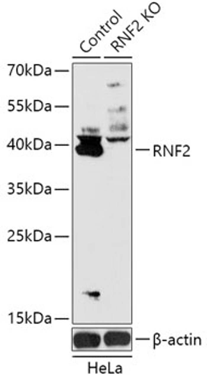 Western blot analysis of extracts from normal (control) and RNF2 knockout (KO) HeLa cells, using RNF2 antibody (18-266) at 1:1000 dilution.<br/>Secondary antibody: HRP Goat Anti-Rabbit IgG (H+L) at 1:10000 dilution.<br/>Lysates/proteins: 25ug per lane.<br/>Blocking buffer: 3% nonfat dry milk in TBST.<br/>Detection: ECL Basic Kit.<br/>Exposure time: 180s.