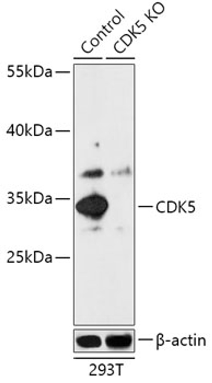 Western blot analysis of extracts from normal (control) and CDK5 knockout (KO) 293T cells, using CDK5 antibody (18-271) at 1:1000 dilution.<br/>Secondary antibody: HRP Goat Anti-Rabbit IgG (H+L) at 1:10000 dilution.<br/>Lysates/proteins: 25ug per lane.<br/>Blocking buffer: 3% nonfat dry milk in TBST.<br/>Detection: ECL Basic Kit.<br/>Exposure time: 90s.