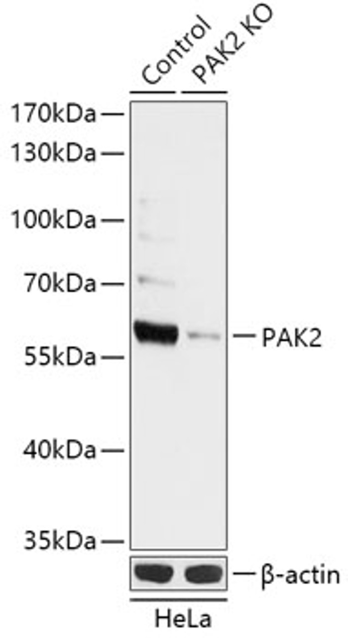 Western blot analysis of extracts from normal (control) and PAK2 knockout (KO) HeLa cells, using PAK2 antibody (18-284) at 1:1000 dilution.<br/>Secondary antibody: HRP Goat Anti-Rabbit IgG (H+L) at 1:10000 dilution.<br/>Lysates/proteins: 25ug per lane.<br/>Blocking buffer: 3% nonfat dry milk in TBST.<br/>Detection: ECL Basic Kit.<br/>Exposure time: 10s.