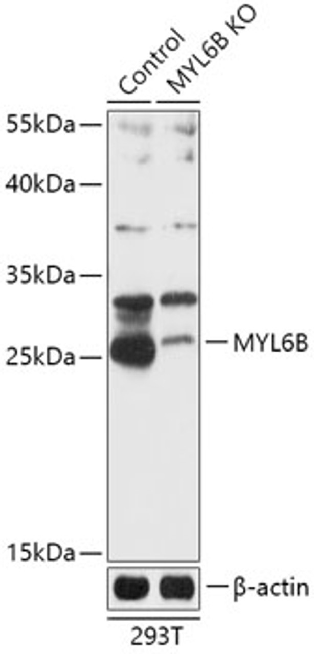 Western blot analysis of extracts from normal (control) and MYL6B knockout (KO) 293T cells, using MYL6B antibody (18-294) at 1:1000 dilution.<br/>Secondary antibody: HRP Goat Anti-Rabbit IgG (H+L) at 1:10000 dilution.<br/>Lysates/proteins: 25ug per lane.<br/>Blocking buffer: 3% nonfat dry milk in TBST.<br/>Detection: ECL Basic Kit.<br/>Exposure time: 10s.