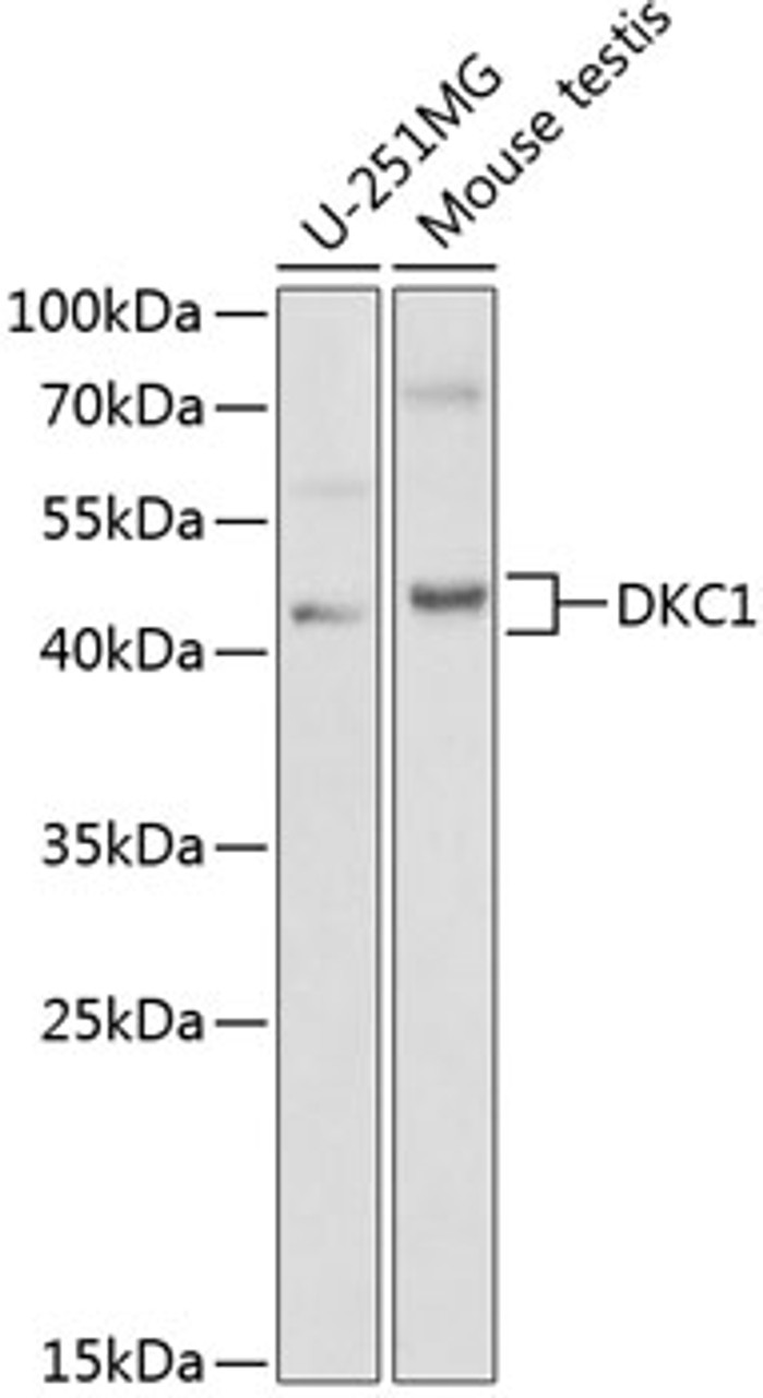 Western blot analysis of extracts of various cell lines, using DKC1 antibody (18-354) at 1:1000 dilution.<br/>Secondary antibody: HRP Goat Anti-Rabbit IgG (H+L) at 1:10000 dilution.<br/>Lysates/proteins: 25ug per lane.<br/>Blocking buffer: 3% nonfat dry milk in TBST.