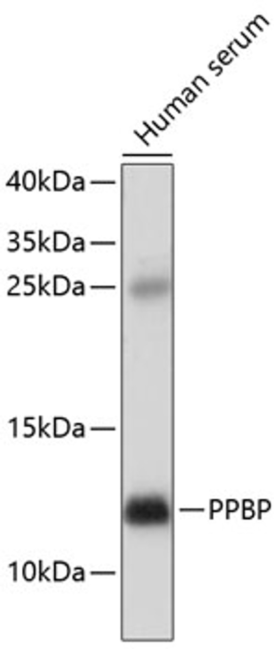 Western blot analysis of extracts of human serum, using PPBP antibody (18-389) at 1:1000 dilution.<br/>Secondary antibody: HRP Goat Anti-Rabbit IgG (H+L) at 1:10000 dilution.<br/>Lysates/proteins: 25ug per lane.<br/>Blocking buffer: 3% nonfat dry milk in TBST.<br/>Detection: ECL Basic Kit.<br/>Exposure time: 5min.