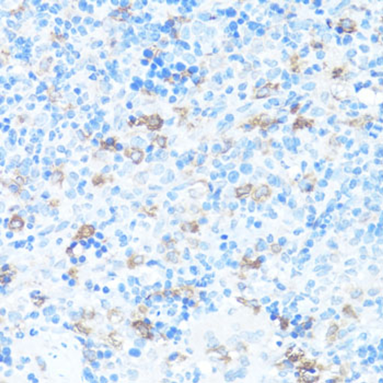 Immunohistochemistry of paraffin-embedded rat spleen using FGFR2 antibody (18-480) at dilution of 1:100 (40x lens) .