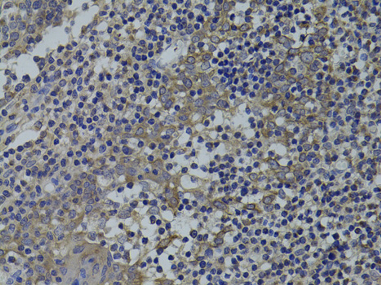 Immunohistochemistry of paraffin-embedded human tonsil using GNA15 antibody (18-484) at dilution of 1:100 (40x lens) .