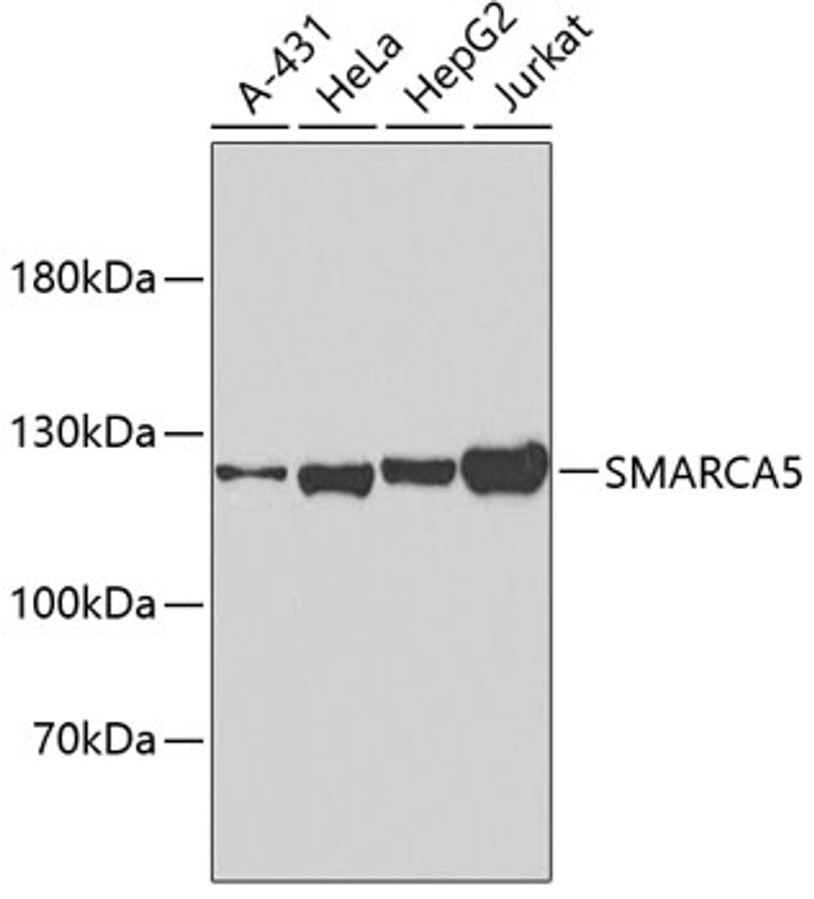 Western blot analysis of extracts of various cell lines, using SMARCA5 antibody (18-598) .<br/>Secondary antibody: HRP Goat Anti-Rabbit IgG (H+L) at 1:10000 dilution.<br/>Lysates/proteins: 25ug per lane.<br/>Blocking buffer: 3% nonfat dry milk in TBST.