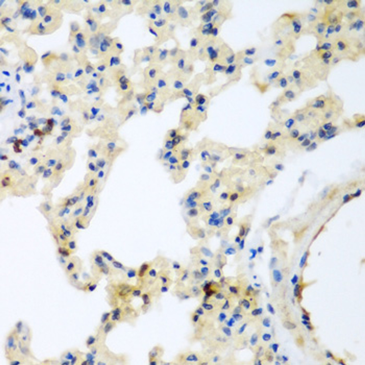 Immunohistochemistry of paraffin-embedded rat lung using LEPREL2 antibody (18-601) at dilution of 1:200 (40x lens) .