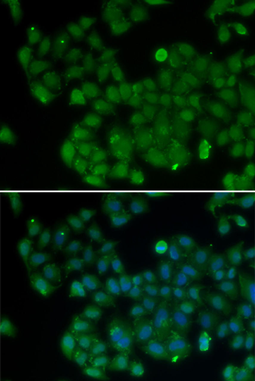 Immunofluorescence analysis of U2OS cells using DNMT3L antibody (18-612) .