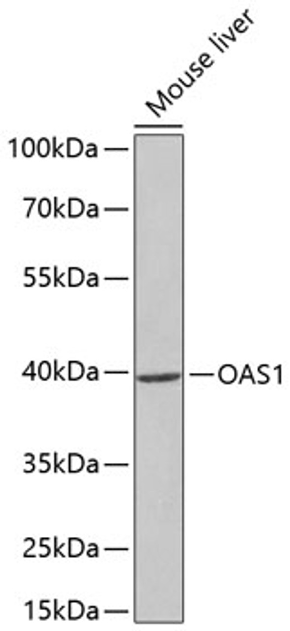 Western blot analysis of extracts of mouse liver, using OAS1 antibody (18-692) at 1:1000 dilution.<br/>Secondary antibody: HRP Goat Anti-Rabbit IgG (H+L) at 1:10000 dilution.<br/>Lysates/proteins: 25ug per lane.<br/>Blocking buffer: 3% nonfat dry milk in TBST.