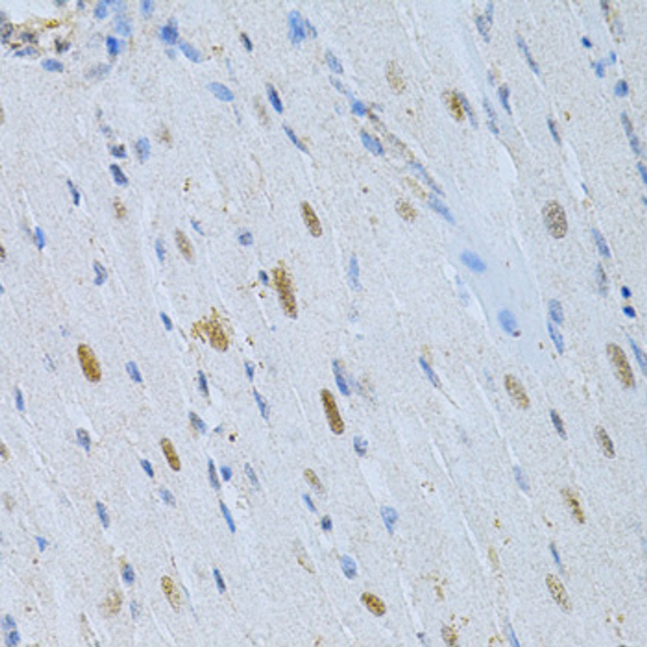 Immunohistochemistry of paraffin-embedded rat heart using MAP2 Antibody (18-718) at dilution of 1:200 (40x lens) .
