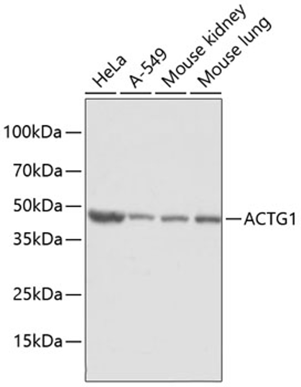Western blot analysis of extracts of various cell lines, using ACTG1 antibody (18-745) .<br/>Secondary antibody: HRP Goat Anti-Rabbit IgG (H+L) at 1:10000 dilution.<br/>Lysates/proteins: 25ug per lane.<br/>Blocking buffer: 3% nonfat dry milk in TBST.