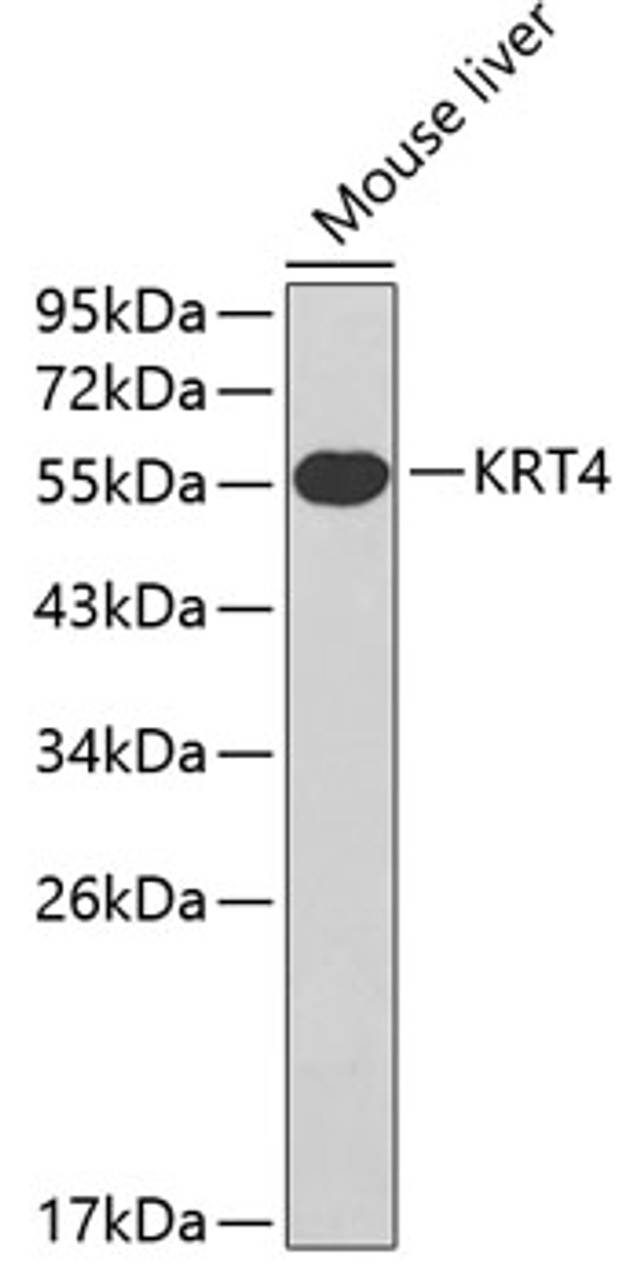 Western blot analysis of extracts of mouse liver, using KRT4 antibody (18-753) .<br/>Secondary antibody: HRP Goat Anti-Rabbit IgG (H+L) at 1:10000 dilution.<br/>Lysates/proteins: 25ug per lane.<br/>Blocking buffer: 3% nonfat dry milk in TBST.