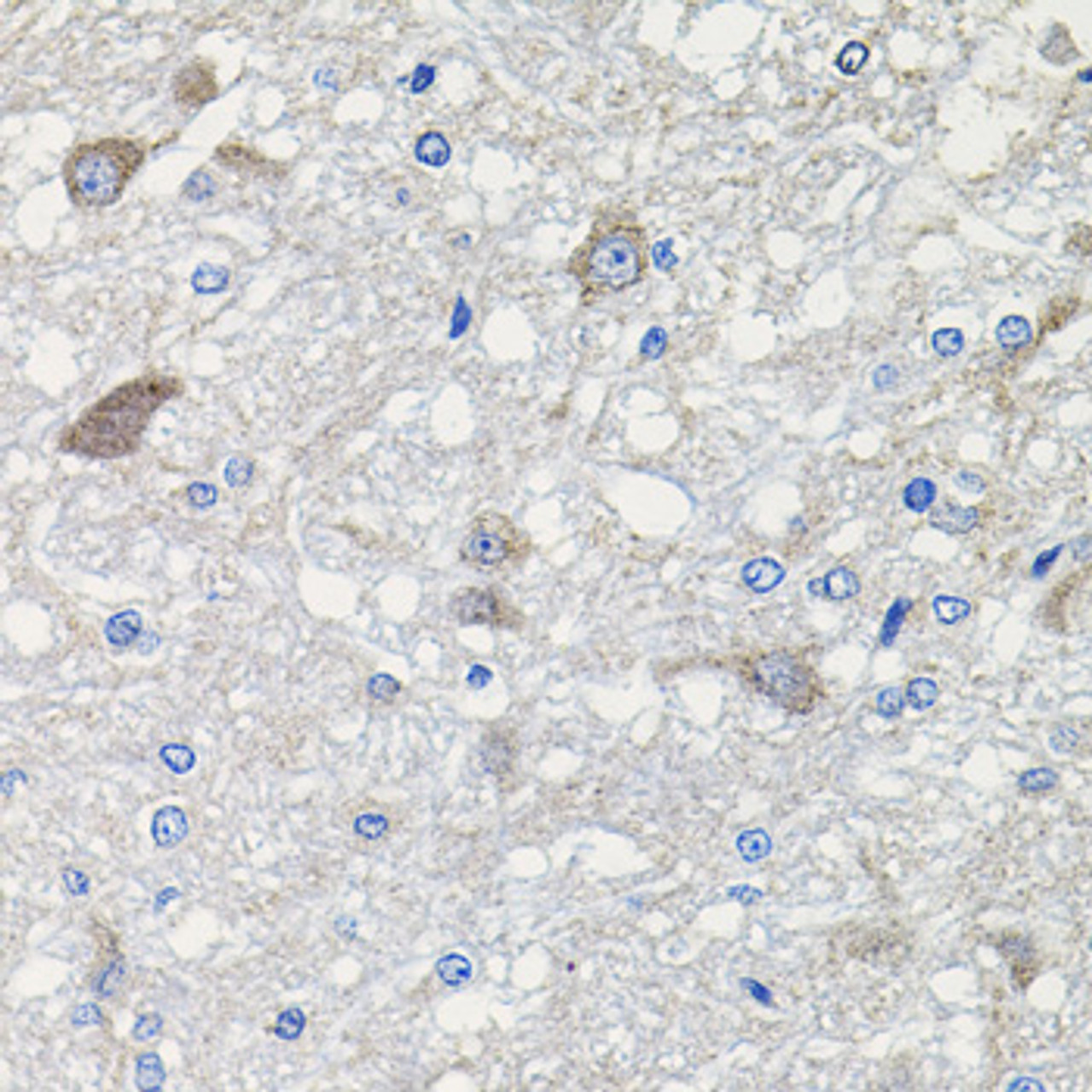 Immunohistochemistry of paraffin-embedded rat brain using CDH23 antibody (18-812) at dilution of 1:100 (40x lens) .