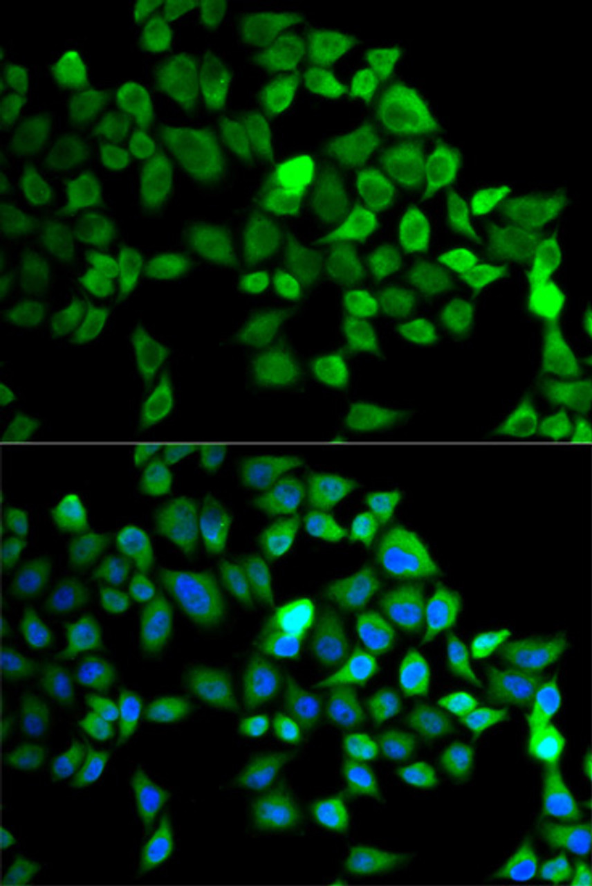 Immunofluorescence analysis of MCF-7 cells using CUL2 antibody (18-845) . Blue: DAPI for nuclear staining.