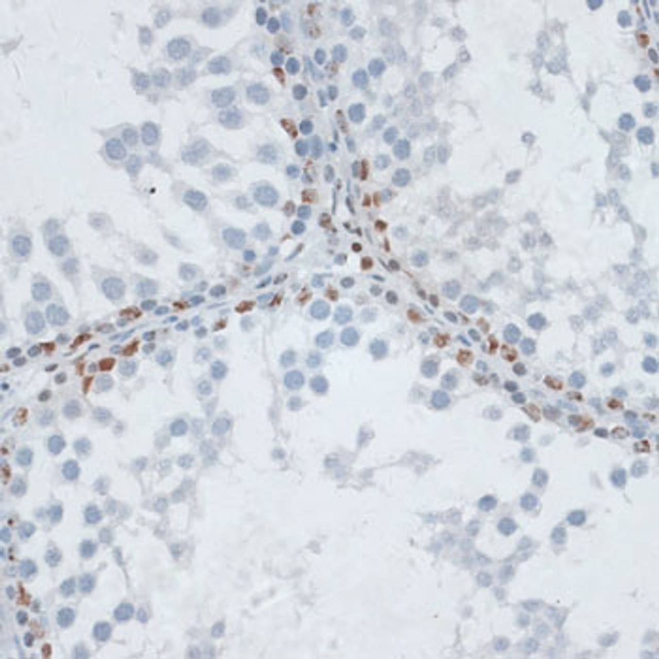 Immunohistochemistry of paraffin-embedded rat testis using HDAC7 antibody (18-889) at dilution of 1:100 (40x lens) .